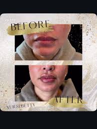 Betty Muñoz (@veronicam575)