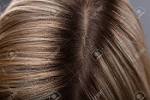 Beginning Lice In Blonde Hair