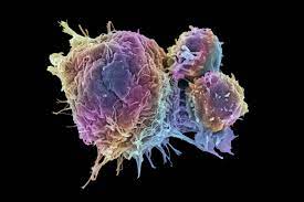 Learn what cancer is and what causes it. Cancer Cells Vs Normal Cells How Are They Different