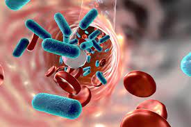 Common signs and symptoms include fever, increased heart rate, increased breathing rate, and confusion. Sepsis Chto Eto Prichiny I Simptomy