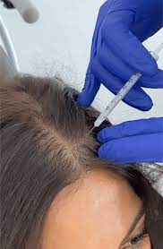 However, these usually improve with time. Steroid Injections For Hair Loss Fact Sheet And Definitive Guide