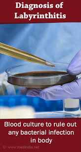 Image result for Bacterial Labyrinthitis