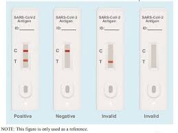2 patients were scanned using computed tomography (ct), which revealed varied opacities (denser, more profuse, and confluent) in comparison to images of healthy lungs. Sars Cov 2 Antigen Rapid Test Kit Elabscience
