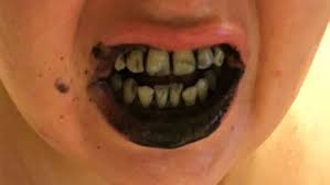 I had not tried the . I Brushed My Teeth With Charcoal For Six Weeks Because A Facebook Ad Told Me To