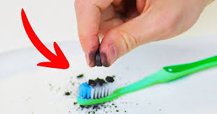 Siempre hay que consultar con un odontólogo antes de probar cualquier cosa. 9 Maneras Eficientes De Blanquear Los Dientes Sin Salir De Casa