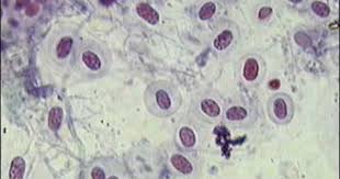 Bacteria No Kingdom In Domain Bacteria Phylum