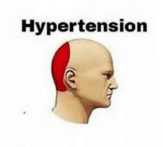 When You Lose A Huge Fish