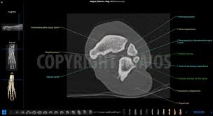 Discover the best cat scratching pads in best sellers. Manus And Carpus Anatomy Of The Dog On Ct