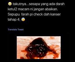 Period datang tapi datang 2 3 hari dah kering. Muhammad Izzat On Twitter Darah Sifatnya Akan Membeku Menjadi Ketulan Darah Tak Kisah Dari Mana Asalnya Darah Tu Pun Hidung Ke Mulut Ke Atau Jari Terluka Atau Darah Period Sekalipun Memang