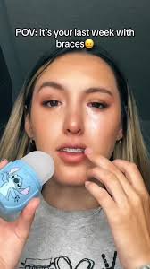 Her teeth are really struggling and it shows