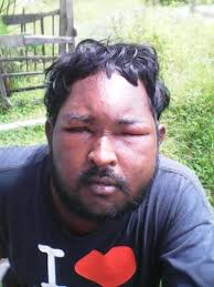 Man stung by Africanised bees succumbs