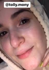 قولولي كدا ع شامبو للقشرة يكون كويس وسعره معقول بس بلاش اعلانات والنبي..