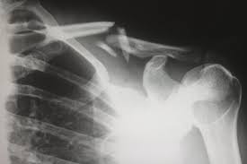 The documentary gives examples from everyday life and current fields of science that use dembski's methods to detect design by finding specified complexity in nature. Unlocking The Mystery Behind Skeletal Aging Ucla