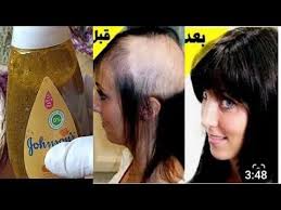 ضعيها في الشامبو لن يتوقف شعرك عن النمو بغزارة و لن يتساقط بعد اليوم ينبت الفراغات و يحارب الصلع Youtube In 2020 Skin Care Mask Skin Care Skin