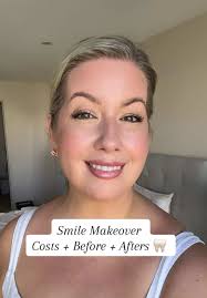 Sonrisa Perfecta: Composite Bonding y Invisalign