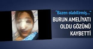Burun Ameliyati Oldu Gozunu Kaybetti Son Dakika Haberler