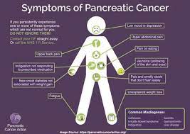 You'll need general anesthesia for this exam. Image Showing The Symptoms Of Pancreatic Cancer Source Download Scientific Diagram