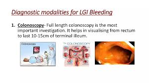 Image result for Colonoscopy in GI Bleeding