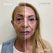 דר רונן מגון