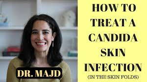 Pin On Yeast Infection Symptoms