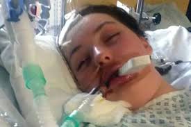 Schoolgirl with headache collapsed into a coma when birthmark