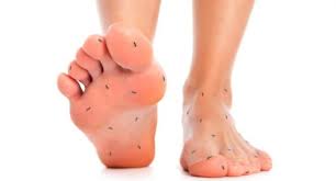 Nak saya kongsikan cara hilangkan masalah. My Health Venture Kebas Kaki Dan Tangan Punca Serta Cara Mengatasinya