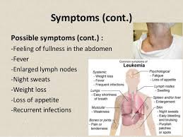 Leukemia Signs And Symptoms In Adults Google Search Leukemia Symptoms Leukemia Night Sweats
