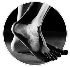Image result for Foot XRay