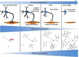 List of 130 smn definitions. Frontiers The Need For Smn Independent Treatments Of Spinal Muscular Atrophy Sma To Complement Smn Enhancing Drugs Neurology