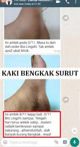 Macam kau telan ubat gigi pun ada. Buah Pinggang Organ Penting Sayangi Badan Anda