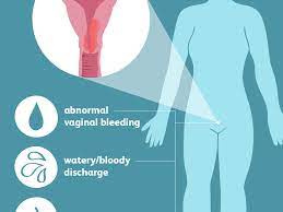 We diagnose cancers of the cervix early in our community. Endometrial Cancer Signs Symptoms And Complications