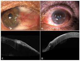 Image result for Pseudoeriosema