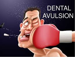 Image result for Tooth Avulsion