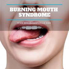 Bitter Taste In My Mouth All Day Symptoms Of Burning Mouth Syndrome Burning Or Scalded Sensation In The Tongue Lips Gums Throat Or Who Burning Mouth Syndrome Top Dentists Dry Mouth