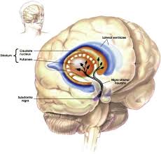 Disease • immunological facotors • hereditary factors • others. 2 Pathophysiology Of Parkinson S Disease Atrain Education