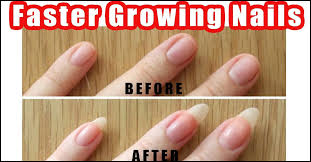 Giving your cuticles the proper tlc — whether in the salon or at home while the jury is still out on whether whether dissolving, trimming, or cutting cuticles is best, choi recommends pushing them back after using a cuticle oil to hydrate them. 25 Easy And Natural Nail Care Tips And Tricks To Try At Home