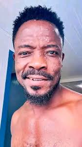 This is the current status of Jabateh the comedian. Lay man gradually  defeating Mpox virus.