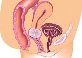 Image result for Pessary