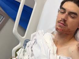 Fundraiser by Jayde Bugatto : Kyle Bugatto, Bike accident