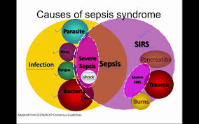 ˈʃɛpʃi ˈoɛʃkaː), sepsi sfântu gheorghe (romanian: Sepsis Physiopedia