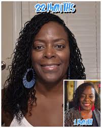 Microlocs journey and progress