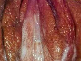 Contoh resi pengiriman obat cv. Nama Obat Sipilis Di Apotik Anjuran Dokter