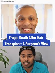Tragic Hair Transplant Death: Insights from Dr. Fernando