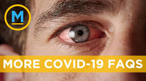 It was first identified in december 2019 in wuhan,. Can Pink Eye Be A Symptom Of Covid 19 Your Morning Youtube