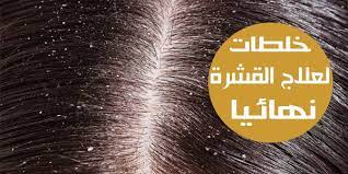 خلطة لازالة القشرة من الشعر نهائيا بشرتك