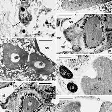 PDF) Sexual reproduction in the Mediterranean solitary coral Balanophyllia  europaea (Scleractinia, Dendrophylliidae)