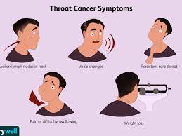 While throat cancer symptoms can vary depending on where exactly the tumor develops, pain or difficulty swallowing is known to be a common symptom across the board. Throat Cancer Signs Symptoms And Complications