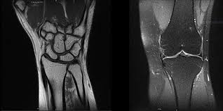 Maybe you would like to learn more about one of these? Kernspintomografie Kst Radiologie Muhlhausen Frechen