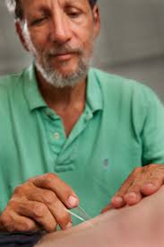 Acupuncture: Traditional Chinese Medicine