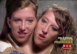 Abigail loraine hensel and brittany lee hensel (born march 7, 1990) are american conjoined twins. Conjoined Twins Abigail And Brittany Hensel Offer A Glimpse In To Their Extraordinary World Daily Mail Online